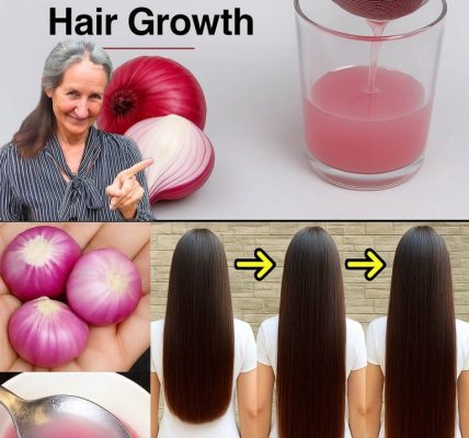 “They Mocked My Onion Oil Ritual — But Now Everyone’s Begging for My Hair Secret” 🌿💁‍♀️