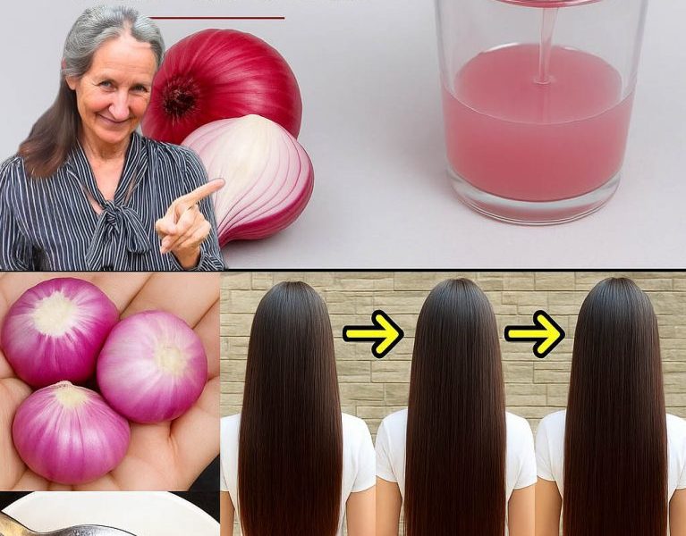 “They Mocked My Onion Oil Ritual — But Now Everyone’s Begging for My Hair Secret” 🌿💁♀️ “They Mocked My Onion Oil Ritual — But Now Everyone’s Begging for My Hair Secret” 🌿💁♀️