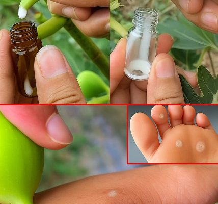 Fig Sap: Collecting and Preparing Nature’s Hidden Elixir Fig Sap: Collecting and Preparing Nature’s Hidden Elixir