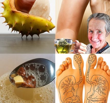 🌿 Horse Chestnut: Unleashing Nature’s Mightiest Remedy for Swollen Legs and Beyond! 🌿 Horse Chestnut: Unleashing Nature’s Mightiest Remedy for Swollen Legs and Beyond!