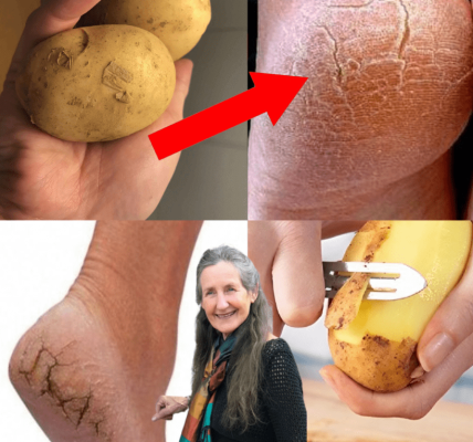 🥔 Say Goodbye to Cracked Heels: The Potato Trick That’s Changing Everything 🥔 Say Goodbye to Cracked Heels: The Potato Trick That’s Changing Everything