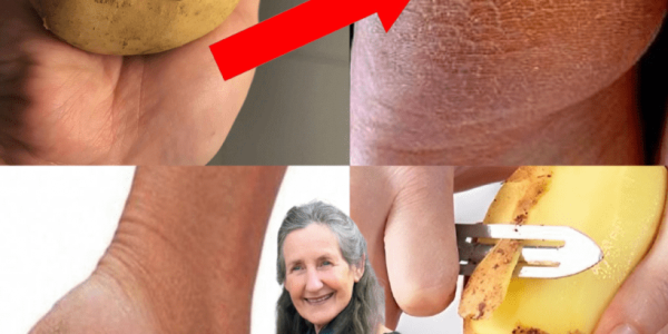 🥔 Say Goodbye to Cracked Heels: The Potato Trick That’s Changing Everything