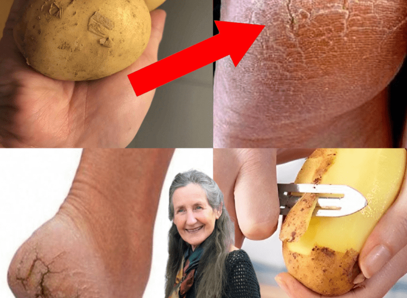 🥔 Say Goodbye to Cracked Heels: The Potato Trick That’s Changing Everything