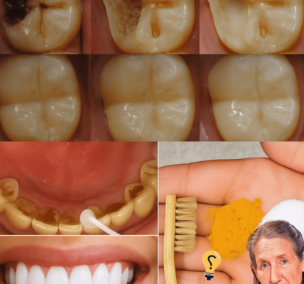 Can Strawberries and Baking Soda Transform Your Smile? The Secret to a Dazzling, Natural Glow! 😁 Can Strawberries and Baking Soda Transform Your Smile? The Secret to a Dazzling, Natural Glow! 😁