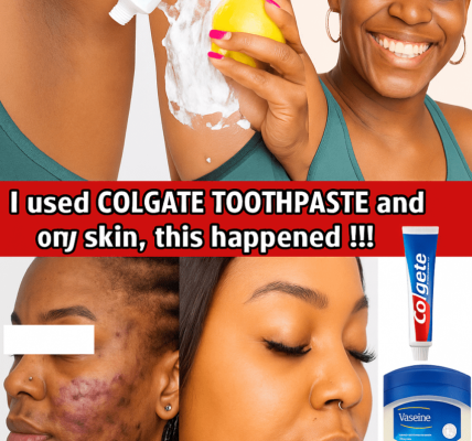 Can Colgate Toothpaste and Lemon Really Transform Your Skin? Unmasking the Viral DIY Glow Hack! 🌟 Can Colgate Toothpaste and Lemon Really Transform Your Skin? Unmasking the Viral DIY Glow Hack! 🌟