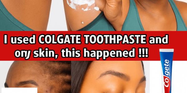 Can Colgate Toothpaste and Lemon Really Transform Your Skin? Unmasking the Viral DIY Glow Hack! 🌟 Can Colgate Toothpaste and Lemon Really Transform Your Skin? Unmasking the Viral DIY Glow Hack! 🌟