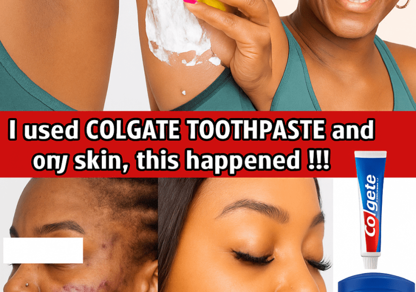 Can Colgate Toothpaste and Lemon Really Transform Your Skin? Unmasking the Viral DIY Glow Hack! đ Can Colgate Toothpaste and Lemon Really Transform Your Skin? Unmasking the Viral DIY Glow Hack! đ