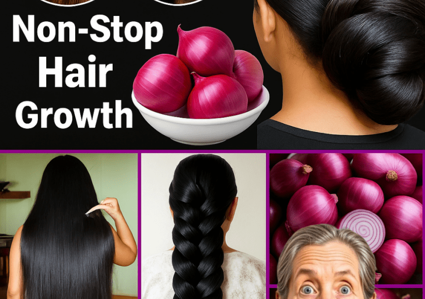 š Shocking Secret to Luscious Locks: Transform Your Hair with This DIY Onion Oil Recipe! š Shocking Secret to Luscious Locks: Transform Your Hair with This DIY Onion Oil Recipe!