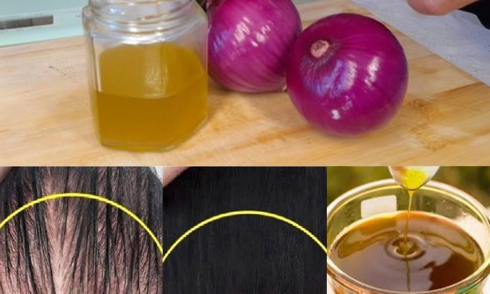 How to Make Onion Hair Oil for Faster Hair Growth and to Stop Hair Fall