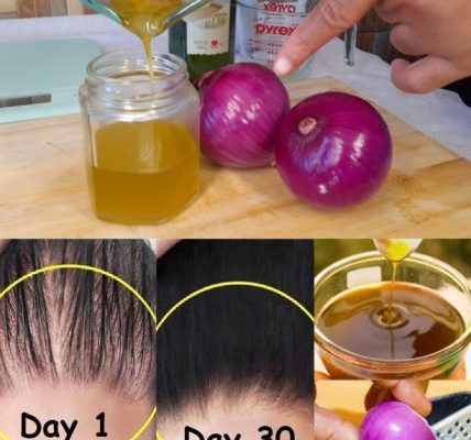 How to Make Onion Hair Oil for Faster Hair Growth and to Stop Hair Fall How to Make Onion Hair Oil for Faster Hair Growth and to Stop Hair Fall