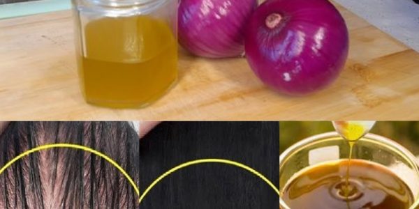 How to Make Onion Hair Oil for Faster Hair Growth and to Stop Hair Fall