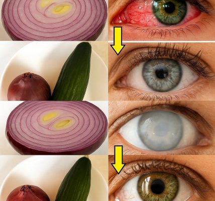 Can Onions Truly Boost Your Vision in Just 5 Days? Discover the Eye-Opening Secret Can Onions Truly Boost Your Vision in Just 5 Days? Discover the Eye-Opening Secret