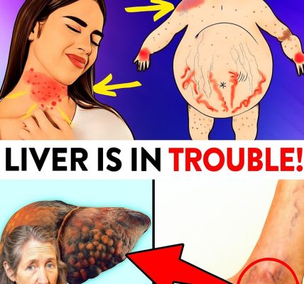 Listen to Your Feet: The Hidden Health Secrets They’re Revealing, Including Liver Warnings! 🦶 Listen to Your Feet: The Hidden Health Secrets They’re Revealing, Including Liver Warnings! 🦶