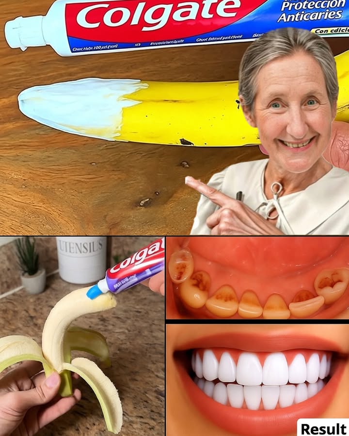 🍌 Can Banana Peels Really Brighten Your Smile? The Truth Behind the Viral Teeth-Whitening Hack 🍌 Can Banana Peels Really Brighten Your Smile? The Truth Behind the Viral Teeth-Whitening Hack