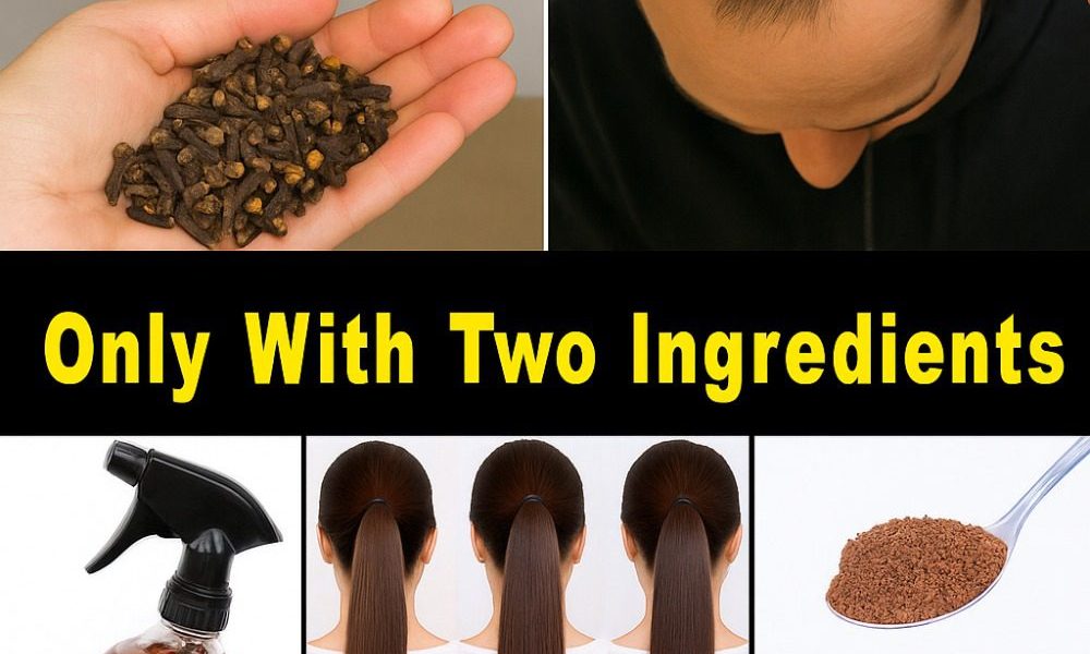 🌿 Nature’s Hidden Gem for Gorgeous Hair: Unlock the Stunning Power of Cloves and Onion Peels in 2025 🌿 Nature’s Hidden Gem for Gorgeous Hair: Unlock the Stunning Power of Cloves and Onion Peels in 2025