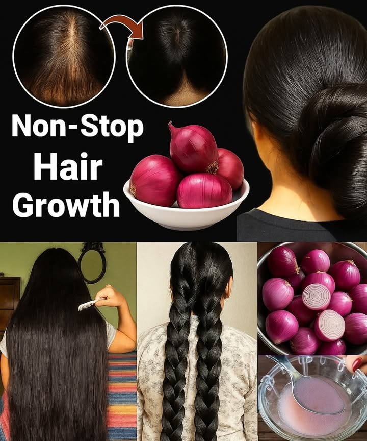 🌿 Onion Hair Oil: The Kitchen Secret to Thicker, Stronger Hair You’ll Wish You Knew Sooner 🌿 Onion Hair Oil: The Kitchen Secret to Thicker, Stronger Hair You’ll Wish You Knew Sooner