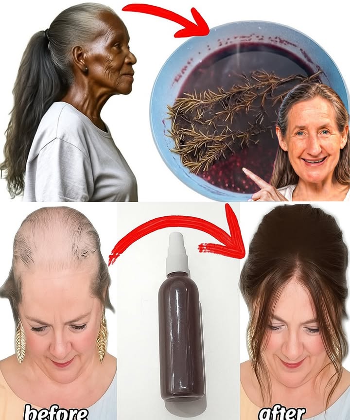 🌿 Rosemary: The Ancient Herb That Could Unlock Your Hair’s Full Potential 🌿 Rosemary: The Ancient Herb That Could Unlock Your Hair’s Full Potential
