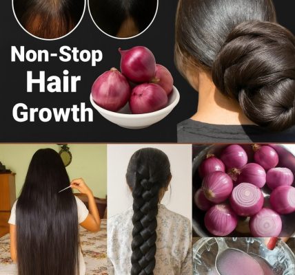 Unlock Luscious Hair with the Hidden Onion Oil Secret in Your Kitchen Unlock Luscious Hair with the Hidden Onion Oil Secret in Your Kitchen