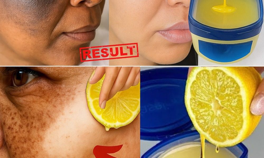 ✨ Glow Like Never Before: The Vaseline and Lemon Hack That Will Transform Your Skin ✨ Glow Like Never Before: The Vaseline and Lemon Hack That Will Transform Your Skin