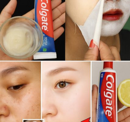 ✨ Colgate and Lemon for Face Whitening: Glow-Up Hack or Skin Disaster Waiting to Happen? ✨ Colgate and Lemon for Face Whitening: Glow-Up Hack or Skin Disaster Waiting to Happen?