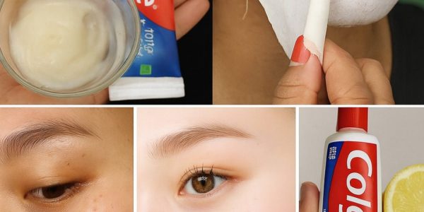 ✨ Colgate and Lemon for Face Whitening: Glow-Up Hack or Skin Disaster Waiting to Happen? ✨ Colgate and Lemon for Face Whitening: Glow-Up Hack or Skin Disaster Waiting to Happen?