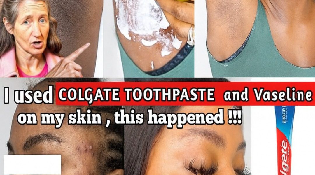 Toothpaste and Lemon for Skin: A Glow-Boosting Trick or a Risky Gamble? Toothpaste and Lemon for Skin: A Glow-Boosting Trick or a Risky Gamble?