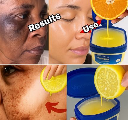 Vaseline and Lemon: The Ultimate Secret to Glowing, Youthful Skin Revealed Vaseline and Lemon: The Ultimate Secret to Glowing, Youthful Skin Revealed