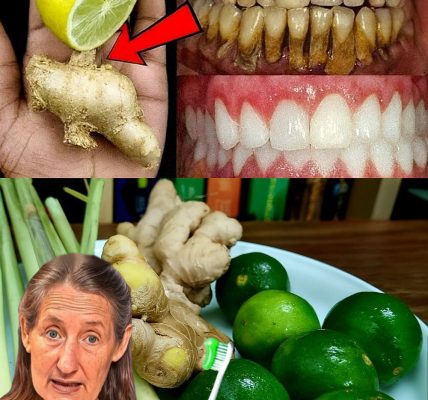 Unlock a Dazzling Smile Overnight: The Ginger and Lime Revolution Awaits! 😁 Unlock a Dazzling Smile Overnight: The Ginger and Lime Revolution Awaits! 😁