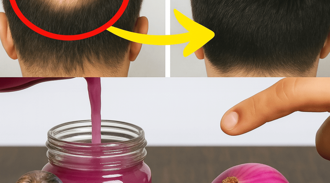 🌿 Unveiling the Secret: Does Onion, Ginger, and Coconut Oil Juice Really Transform Hair Loss into Luscious Locks? 🌿 Unveiling the Secret: Does Onion, Ginger, and Coconut Oil Juice Really Transform Hair Loss into Luscious Locks?