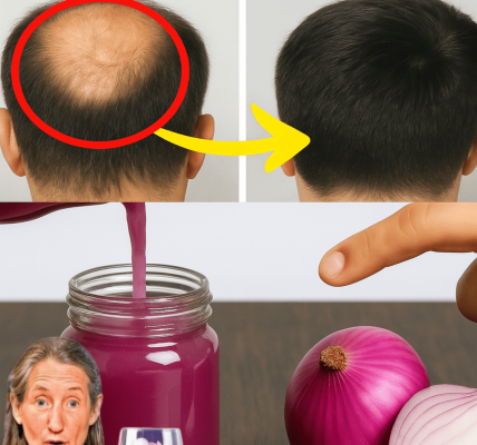 🌿 Unveiling the Secret: Does Onion, Ginger, and Coconut Oil Juice Really Transform Hair Loss into Luscious Locks? 🌿 Unveiling the Secret: Does Onion, Ginger, and Coconut Oil Juice Really Transform Hair Loss into Luscious Locks?