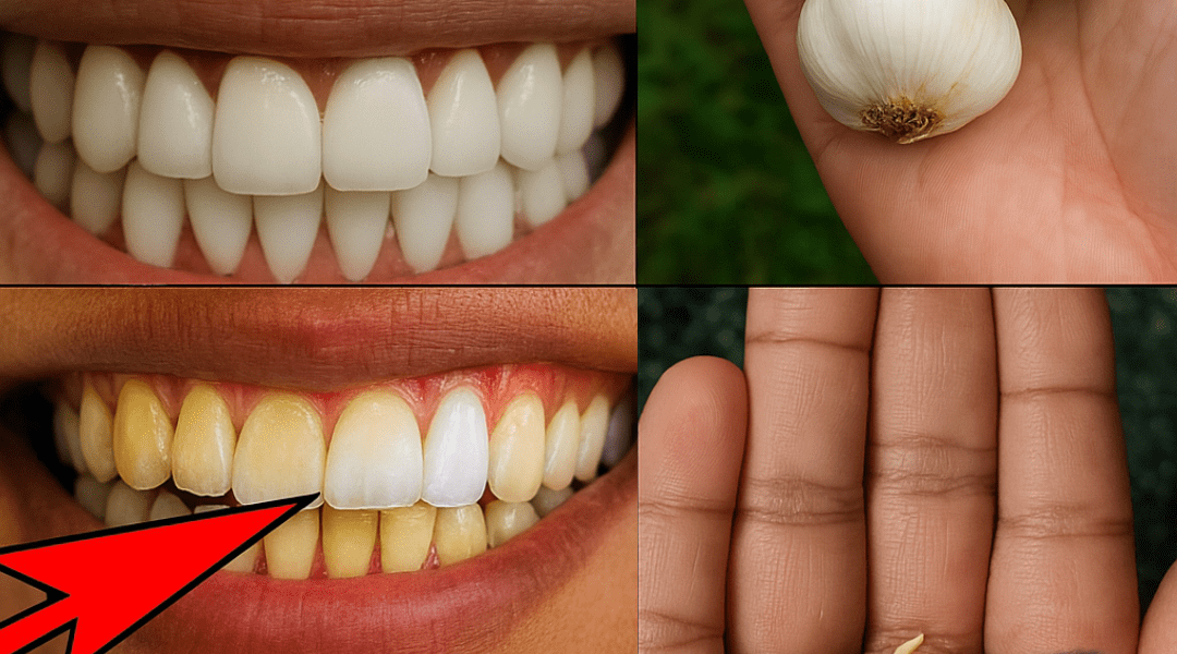 🌟 Garlic: The Hidden Key to Pearly White Teeth You’ve Never Considered 🌟 Garlic: The Hidden Key to Pearly White Teeth You’ve Never Considered