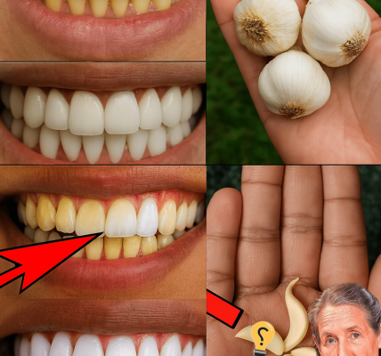 🌟 Garlic: The Hidden Key to Pearly White Teeth You’ve Never Considered 🌟 Garlic: The Hidden Key to Pearly White Teeth You’ve Never Considered