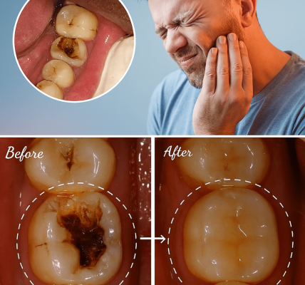 Unlock the Secret to a Radiant Smile: 7 Natural Tips and 5 Powerful Remedies to Keep Your Teeth Healthy and Cavity-Free Unlock the Secret to a Radiant Smile: 7 Natural Tips and 5 Powerful Remedies to Keep Your Teeth Healthy and Cavity-Free