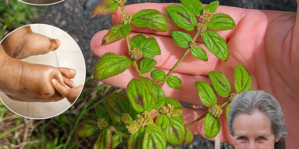 🌿 Unlock the Healing Secrets of Euphorbia Hirta: 9 Powerful Health Benefits You Need to Know 🌿 Unlock the Healing Secrets of Euphorbia Hirta: 9 Powerful Health Benefits You Need to Know