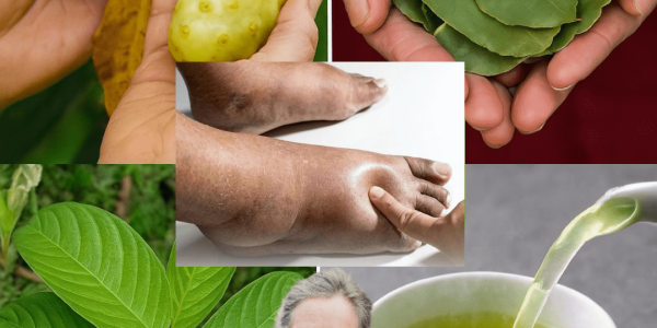 🌿 Unlock the Hidden Power: How Guava Leaves, Noni Fruit, and Bay Leaves Could Transform Your Health