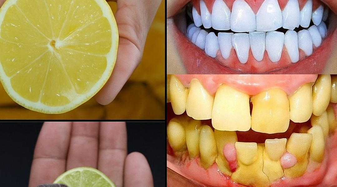 Discover the Magic of a Radiant Smile: Why Baking Soda and Lemon Are Your Teeth’s New Best Friends! 😁 Discover the Magic of a Radiant Smile: Why Baking Soda and Lemon Are Your Teeth’s New Best Friends! 😁
