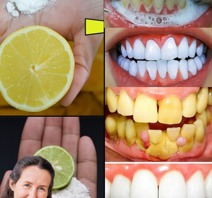Discover the Magic of a Radiant Smile: Why Baking Soda and Lemon Are Your Teeth’s New Best Friends! 😁 Discover the Magic of a Radiant Smile: Why Baking Soda and Lemon Are Your Teeth’s New Best Friends! 😁