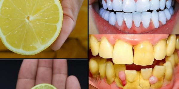 Discover the Magic of a Radiant Smile: Why Baking Soda and Lemon Are Your Teeth’s New Best Friends! 😁 Discover the Magic of a Radiant Smile: Why Baking Soda and Lemon Are Your Teeth’s New Best Friends! 😁