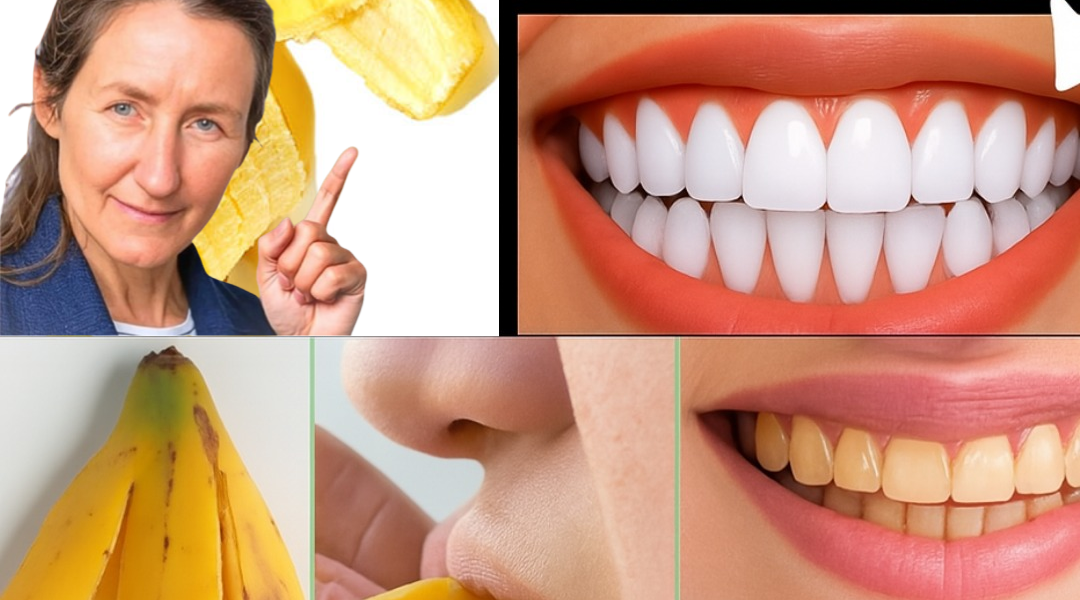 đ Unlock a Dazzling Smile in 2 Minutes with a Banana Peel Secret đ Unlock a Dazzling Smile in 2 Minutes with a Banana Peel Secret