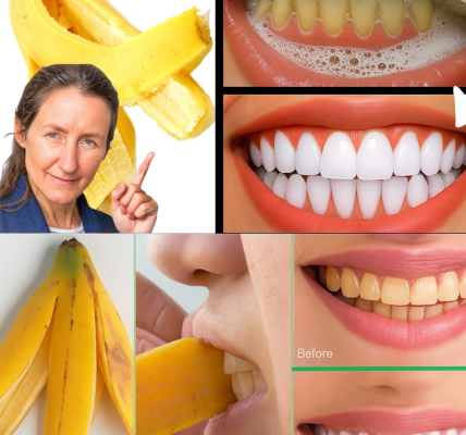 🍌 Unlock a Dazzling Smile in 2 Minutes with a Banana Peel Secret 🍌 Unlock a Dazzling Smile in 2 Minutes with a Banana Peel Secret