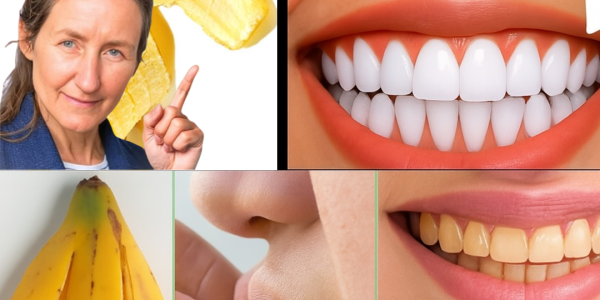 š Unlock a Dazzling Smile in 2 Minutes with a Banana Peel Secret š Unlock a Dazzling Smile in 2 Minutes with a Banana Peel Secret