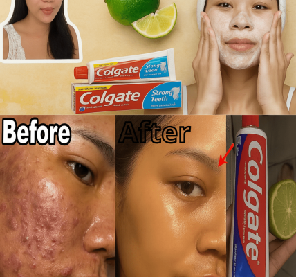 Can Colgate Toothpaste and Lemon Really Brighten Your Skin? The Shocking Truth Revealed Can Colgate Toothpaste and Lemon Really Brighten Your Skin? The Shocking Truth Revealed