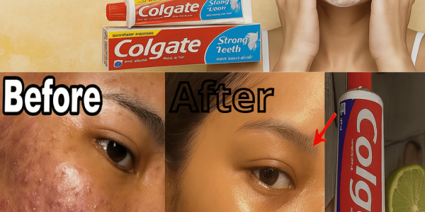 Can Colgate Toothpaste and Lemon Really Brighten Your Skin? The Shocking Truth Revealed