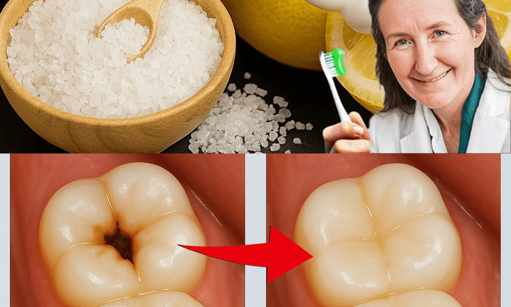 🌟 Unveiling the Shocking Tooth-Whitening Power of Lemon and Salt: A Natural Dental Revolution 🌟 Unveiling the Shocking Tooth-Whitening Power of Lemon and Salt: A Natural Dental Revolution