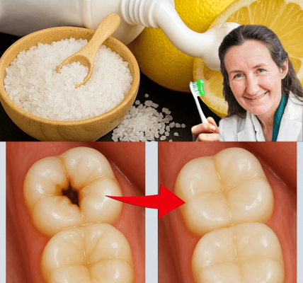 🌟 Unveiling the Shocking Tooth-Whitening Power of Lemon and Salt: A Natural Dental Revolution 🌟 Unveiling the Shocking Tooth-Whitening Power of Lemon and Salt: A Natural Dental Revolution