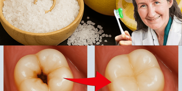 🌟 Unveiling the Shocking Tooth-Whitening Power of Lemon and Salt: A Natural Dental Revolution