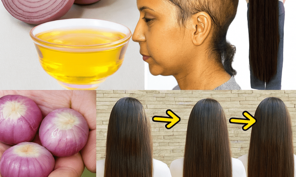🧅✨ Unlock Luscious Locks: The Surprising Power of Onion Oil for Hair Growth 🧅✨ Unlock Luscious Locks: The Surprising Power of Onion Oil for Hair Growth