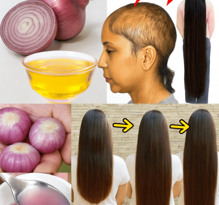 🧅✨ Unlock Luscious Locks: The Surprising Power of Onion Oil for Hair Growth
