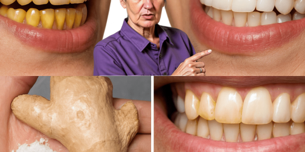 Ginger and Baking Soda: The Natural Duo to Banish Dental Plaque