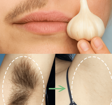 šæ Ditch the Razor: 3 Natural Hair Removal Remedies That Deliver Smooth, Glowing Skin šæ Ditch the Razor: 3 Natural Hair Removal Remedies That Deliver Smooth, Glowing Skin